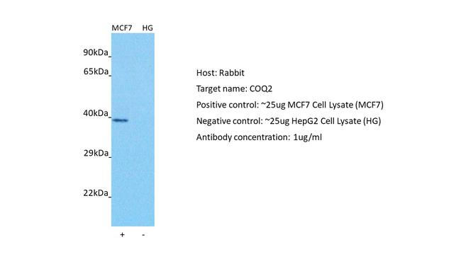 COQ2 Antibody in Western Blot (WB)