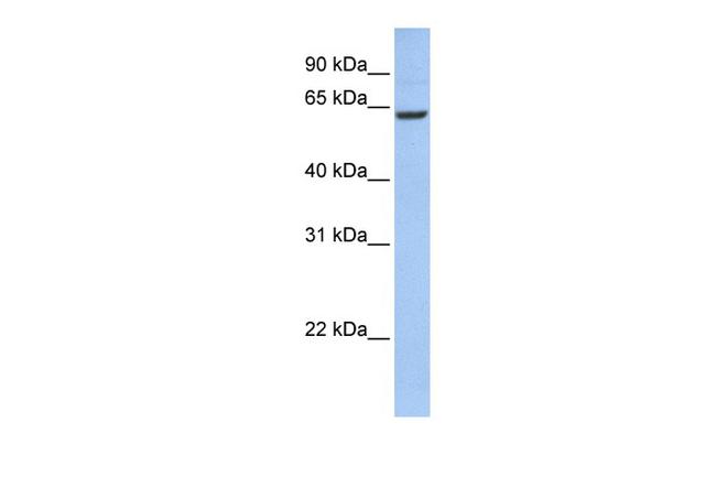 CCDC67 Antibody in Western Blot (WB)