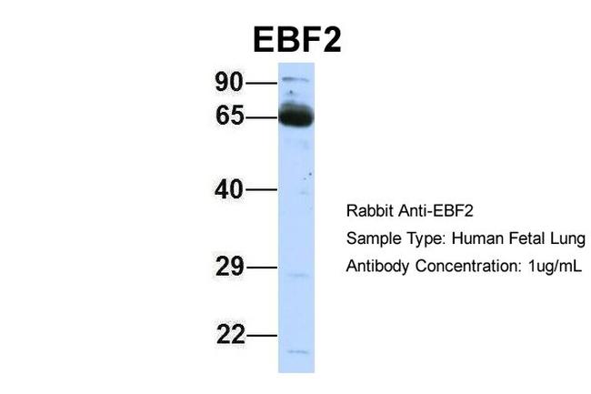 EBF2 Antibody in Western Blot (WB)