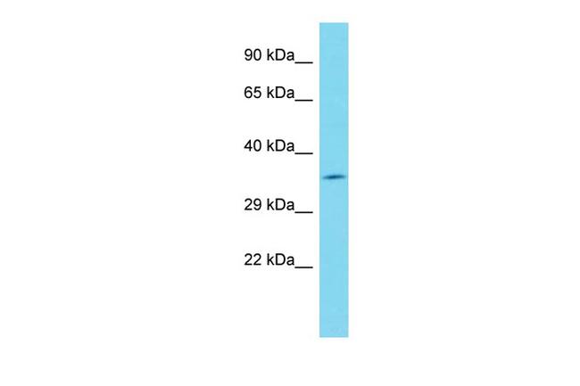 FAM49A Antibody in Western Blot (WB)