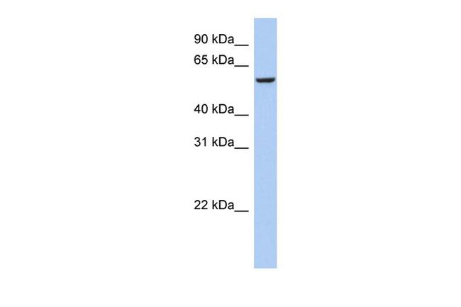 FBXO33 Antibody in Western Blot (WB)