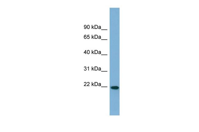 FNDC4 Antibody in Western Blot (WB)