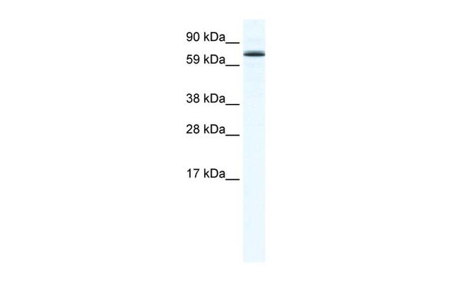 FOXO6 Antibody in Western Blot (WB)