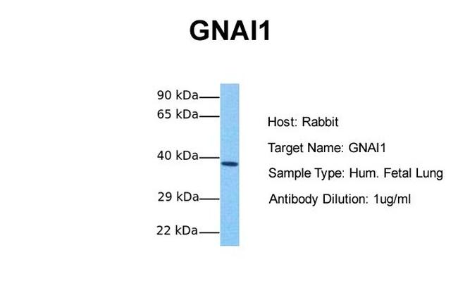 GNAI1 Antibody in Western Blot (WB)