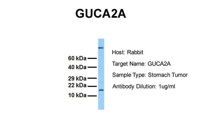 GUCA2A Antibody in Western Blot (WB)