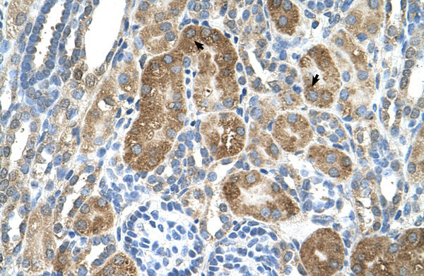 LY6G6F Antibody in Immunohistochemistry (IHC)