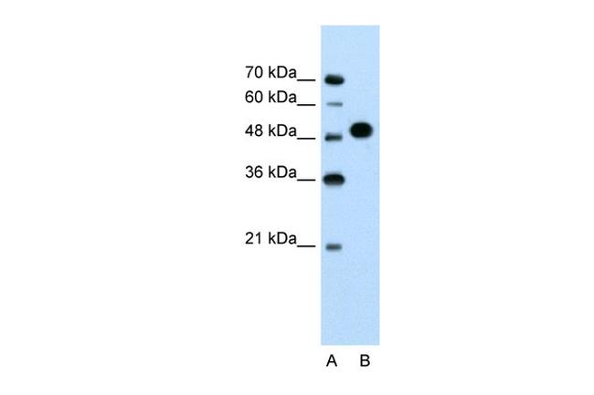 MKRN1 Antibody in Western Blot (WB)