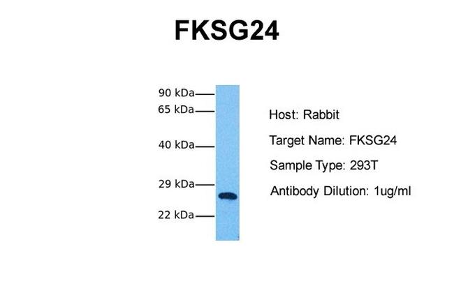 MPV17L2 Antibody in Western Blot (WB)