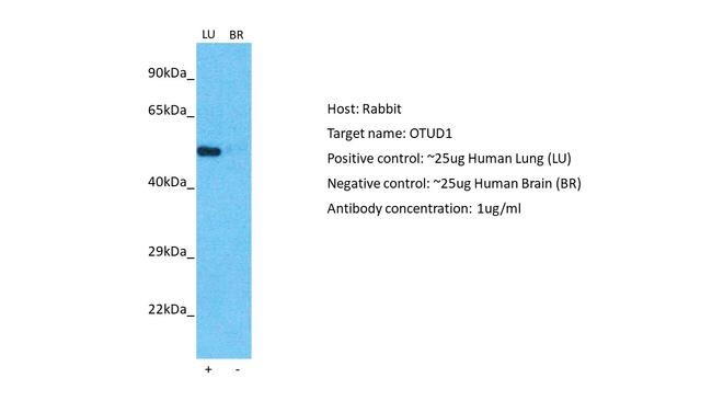 OTUD1 Antibody in Western Blot (WB)