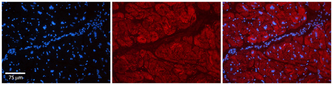 PARP16 Antibody in Immunohistochemistry (Paraffin) (IHC (P))