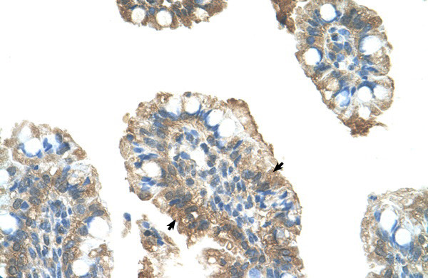 PARP6 Antibody in Immunohistochemistry (IHC)