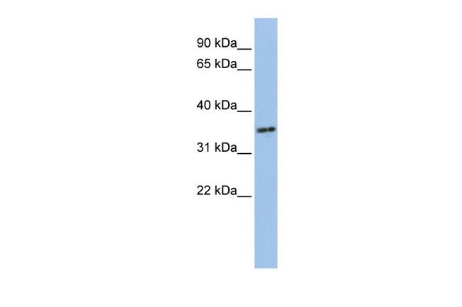 PHF13 Antibody in Western Blot (WB)