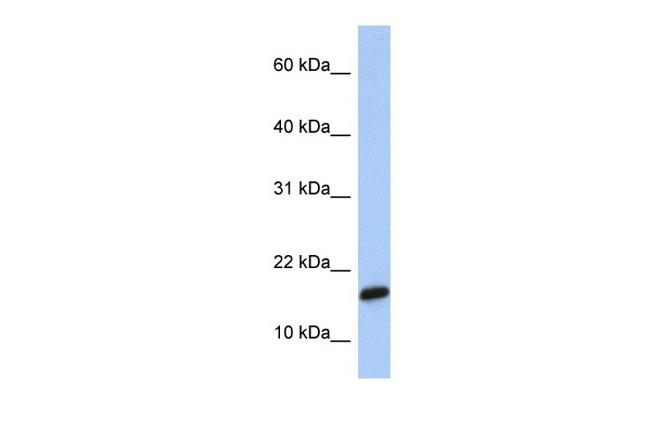 PLGRKT Antibody in Western Blot (WB)