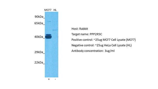 PPP2R5C Antibody in Western Blot (WB)