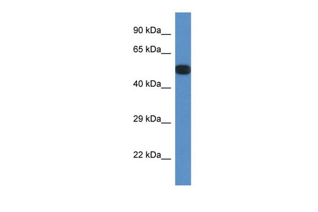 PPP2R5E Antibody in Western Blot (WB)