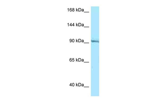 RASGRP1 Antibody in Western Blot (WB)