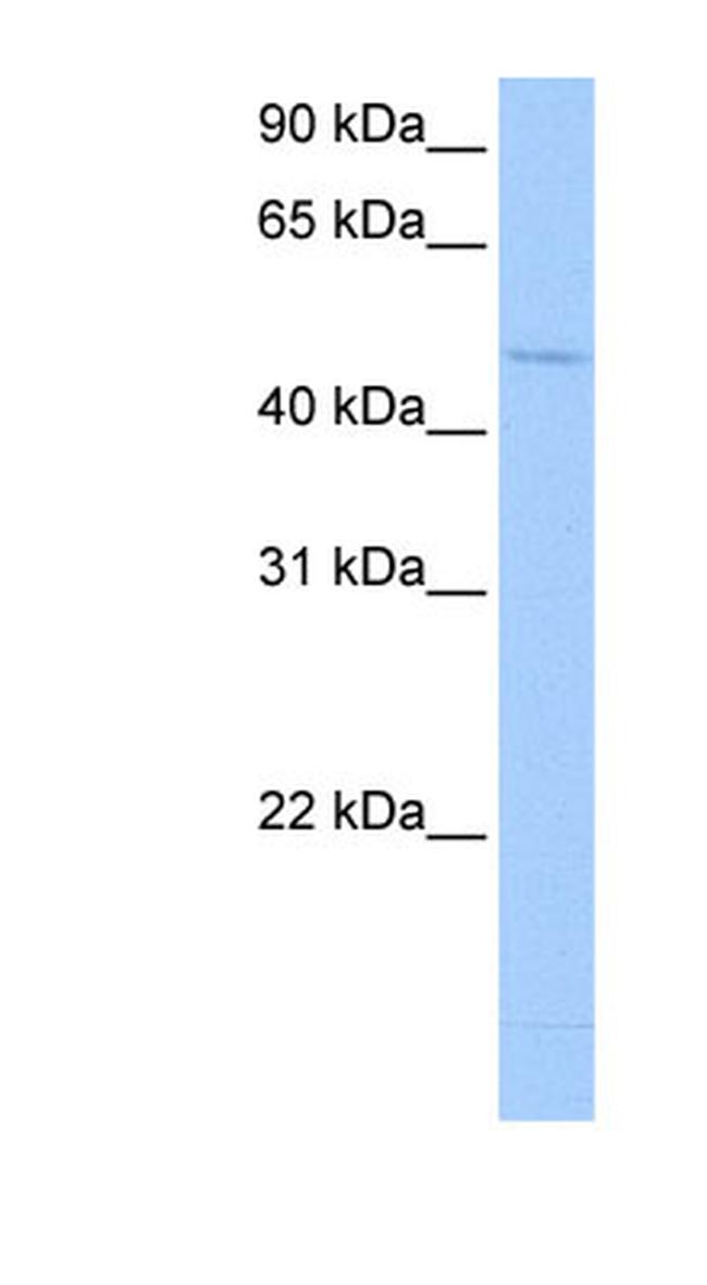 DRB1 Antibody in Western Blot (WB)