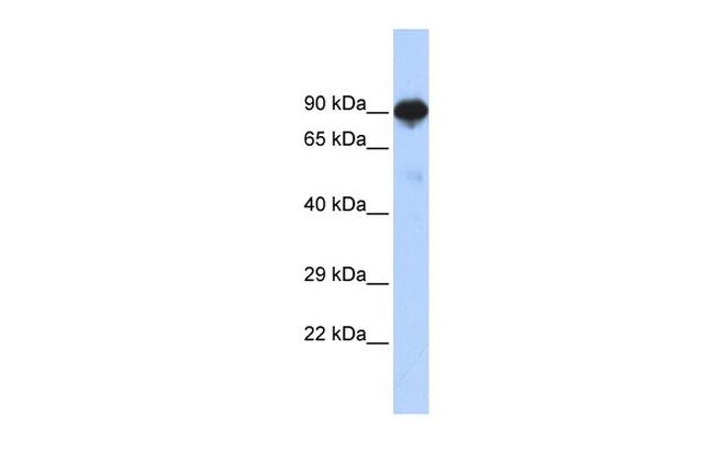RFX4 Antibody in Western Blot (WB)