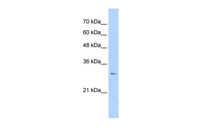 RHBDL2 Antibody in Western Blot (WB)