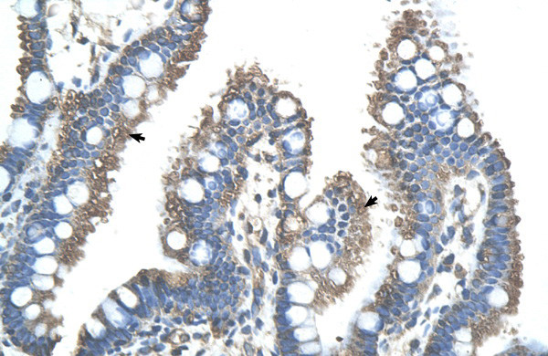 RNF121 Antibody in Immunohistochemistry (IHC)