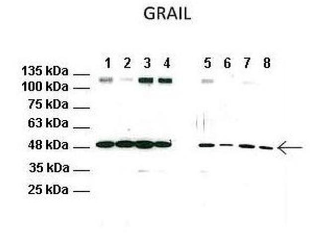 RNF128 Antibody in Western Blot (WB)