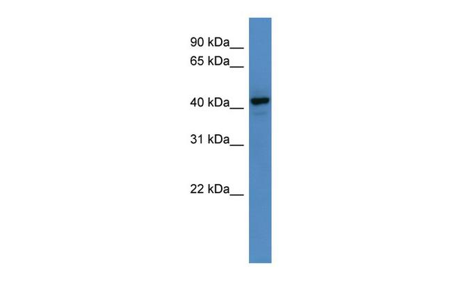 RNF128 Antibody in Western Blot (WB)