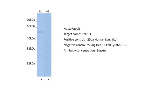 RNPC3 Antibody in Western Blot (WB)