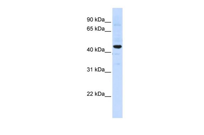 SLC41A3 Antibody in Western Blot (WB)