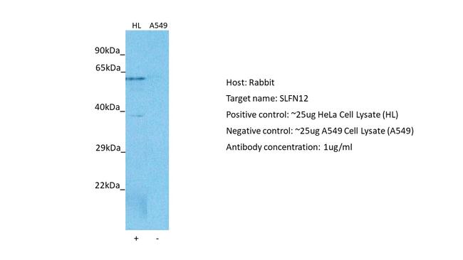 SLFN12 Antibody in Western Blot (WB)