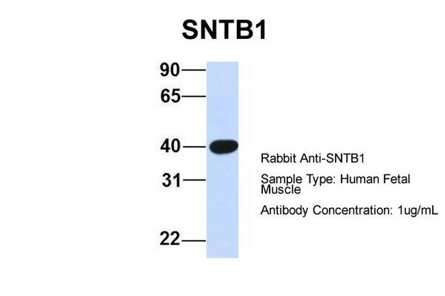 SNTB1 Antibody in Western Blot (WB)