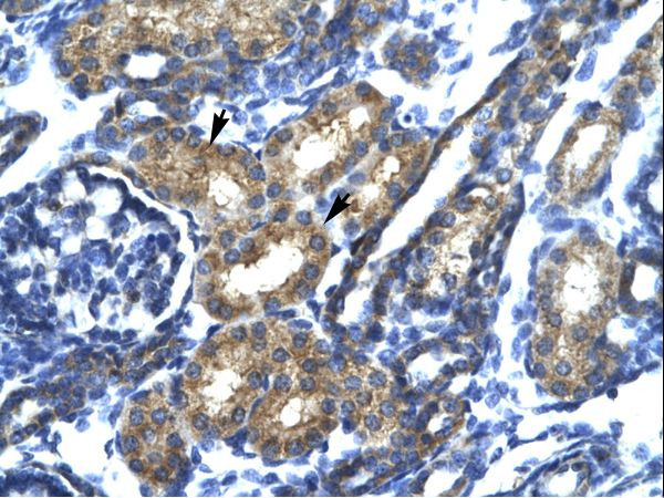 SP140 Antibody in Immunohistochemistry (Paraffin) (IHC (P))