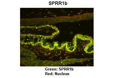 SPRR1B Antibody in Immunohistochemistry (IHC)