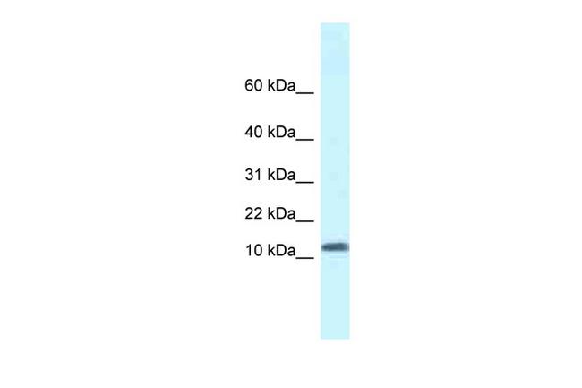 SSBP1 Antibody in Western Blot (WB)