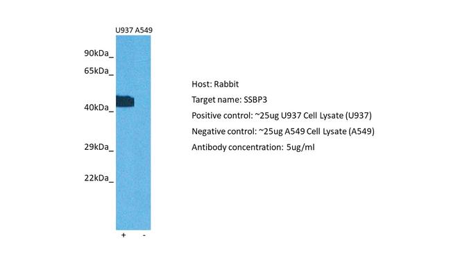 SSBP3 Antibody in Western Blot (WB)