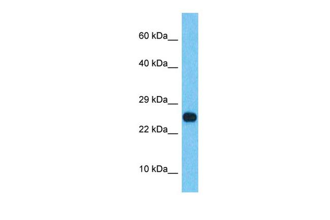 SSX2B Antibody in Western Blot (WB)