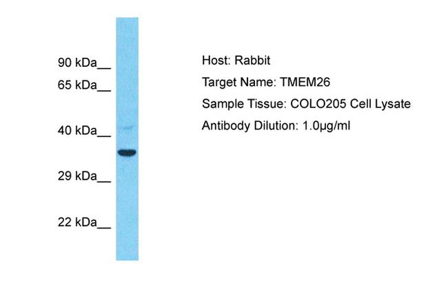 TMEM26 Antibody in Western Blot (WB)