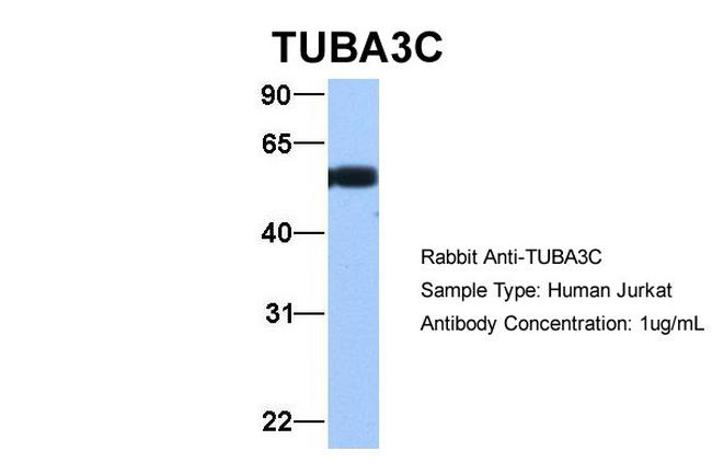 TUBA3C Antibody in Western Blot (WB)