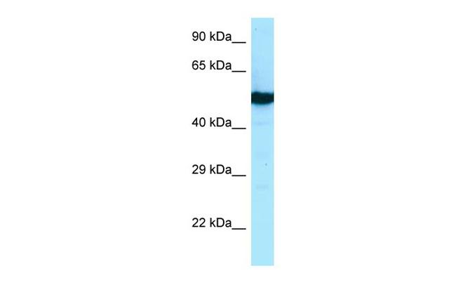 beta Tubulin 2 Antibody in Western Blot (WB)