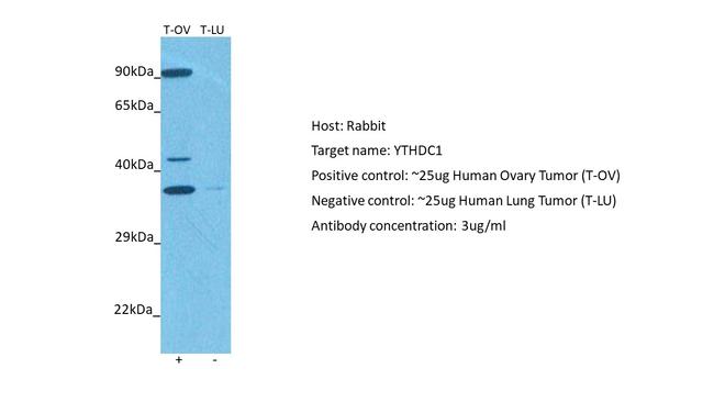 YTHDC1 Antibody in Western Blot (WB)