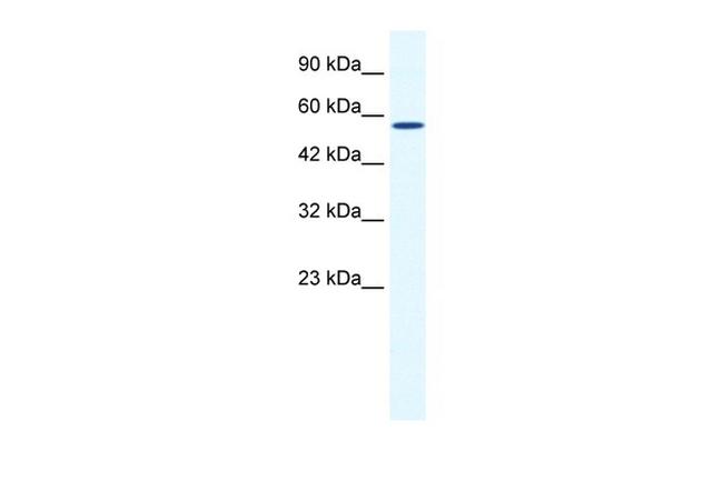 ZBTB44 Antibody in Western Blot (WB)