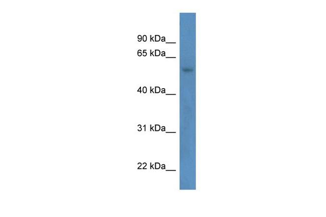 ZNF692 Antibody in Western Blot (WB)