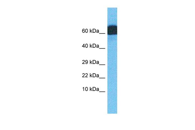 ZNF746 Antibody in Western Blot (WB)