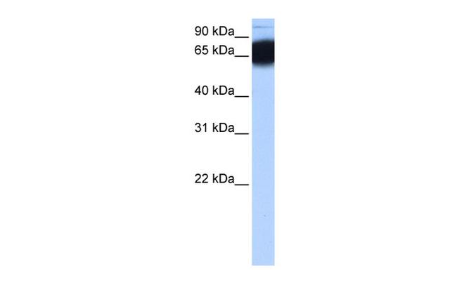 ZNF90 Antibody in Western Blot (WB)