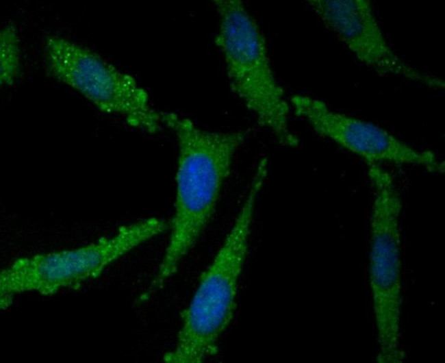 NOD3 Antibody in Immunocytochemistry (ICC/IF)