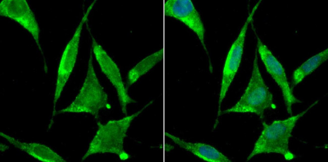 ZBTB48 Antibody in Immunocytochemistry (ICC/IF)
