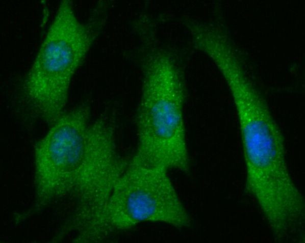 FAP Antibody in Immunocytochemistry (ICC/IF)
