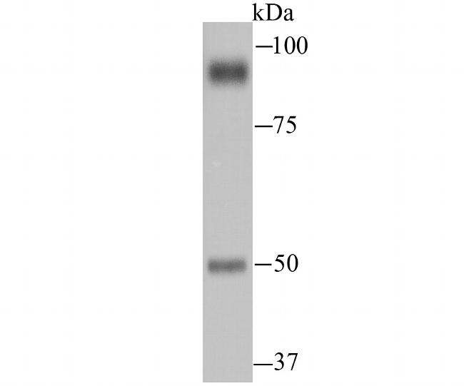 PSMA Antibody in Western Blot (WB)