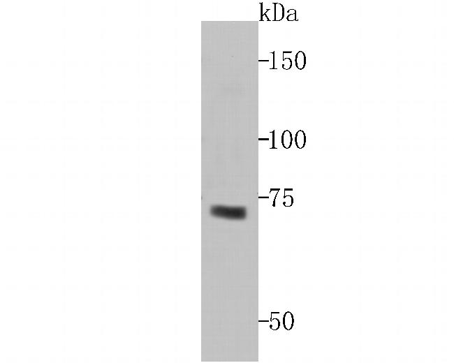 Hemagglutinin-Neuraminidase Antibody in Western Blot (WB)