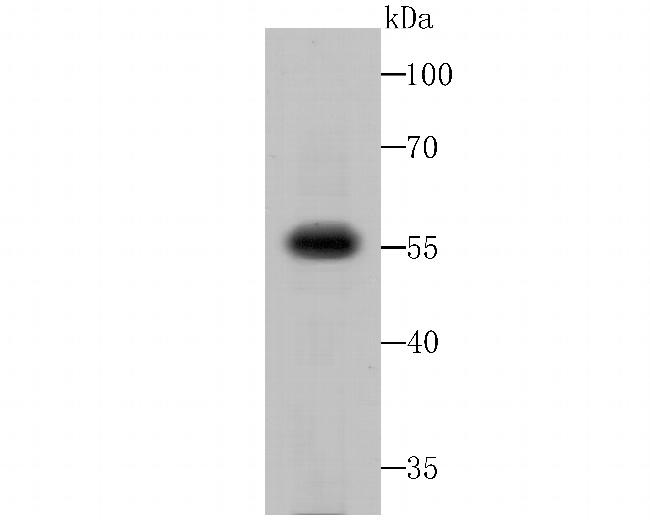 Fusion glycoprotein F0 Antibody in Western Blot (WB)