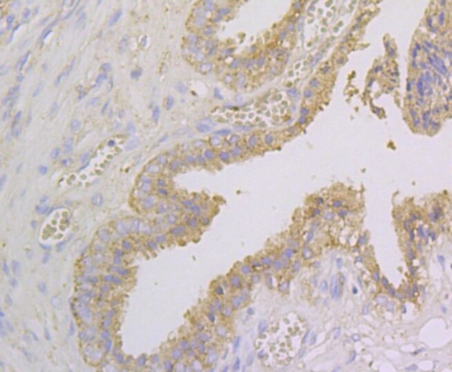 NDRG2 Antibody in Immunohistochemistry (Paraffin) (IHC (P))